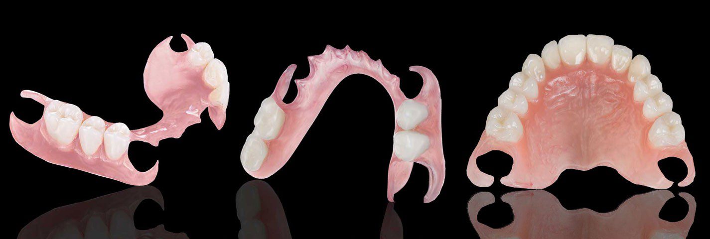 Removable Partial and Flexible Dentures Images
