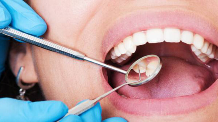 Tips for Keeping Your Mouth Healthy