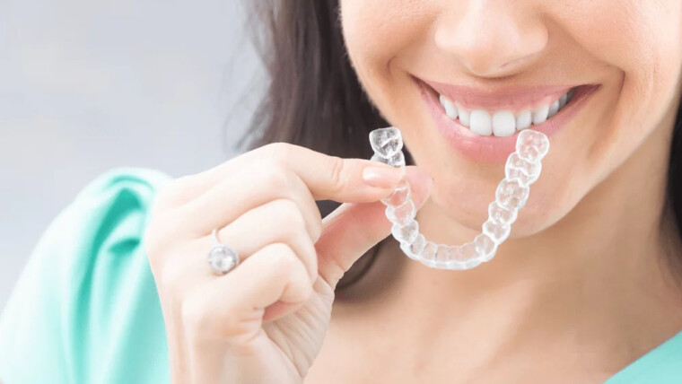Everything to Know About Braces