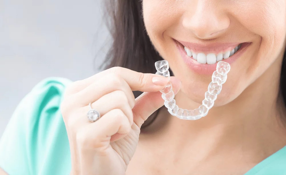 Everything to Know About Braces