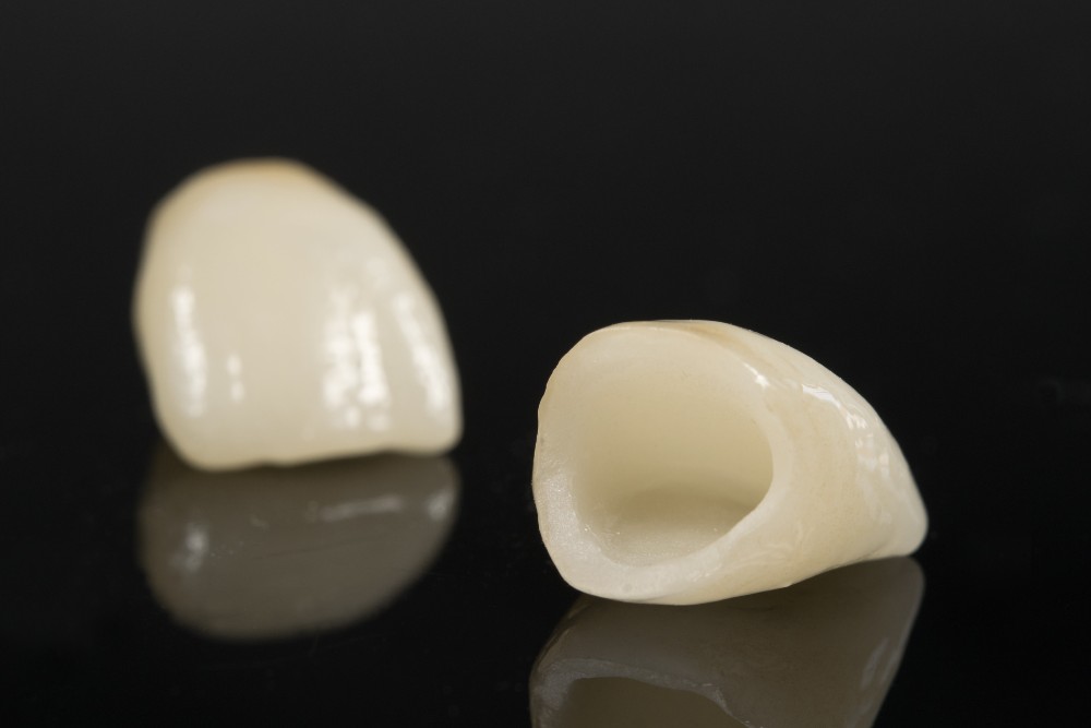 Dental Crowns Images