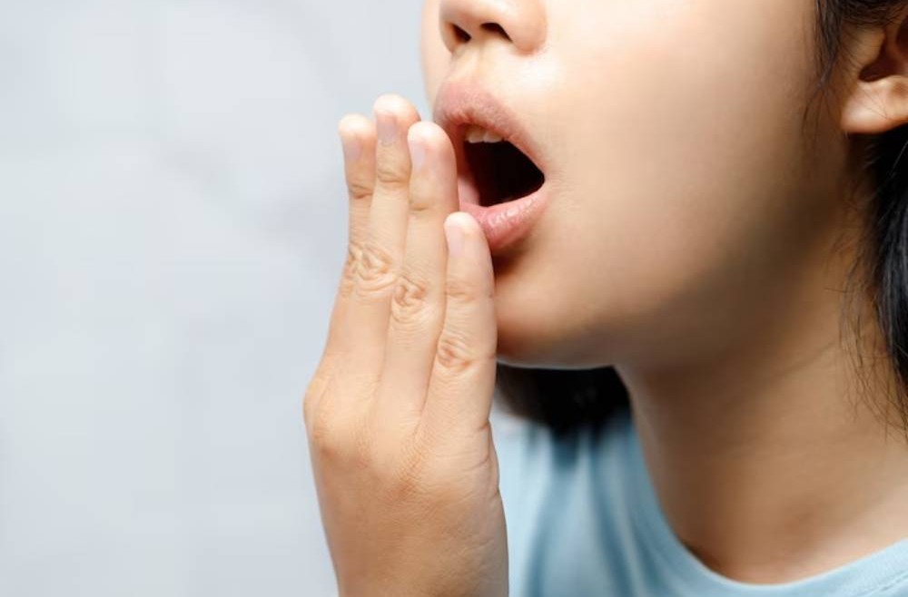 Say Goodbye to Bad Breath: Effective Home Remedies to Freshen Your Breath Naturally