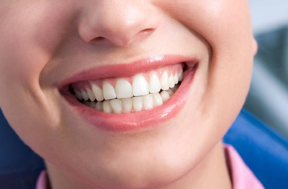 From Imperfect to Perfect: How Dental Veneers Can Transform Your Smile.