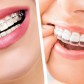 The Benefits of Orthodontic Treatment Beyond Aesthetics.