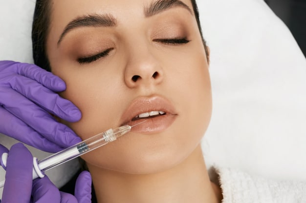 facial fillers images
